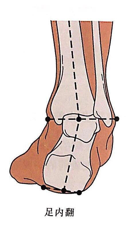 足内翻
