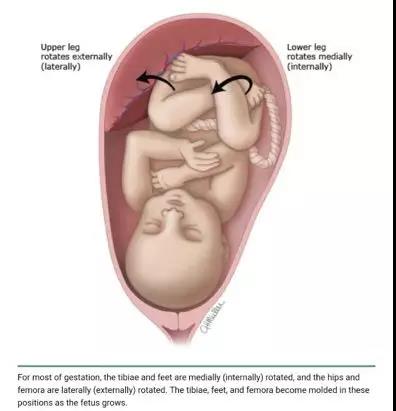 在母亲肚子里腿部是内八字形状